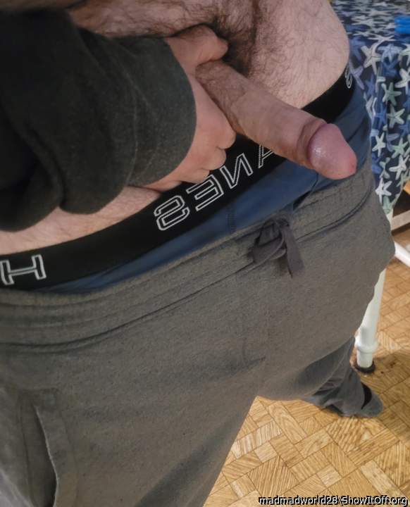 Photo of a middle leg from madmadworld28