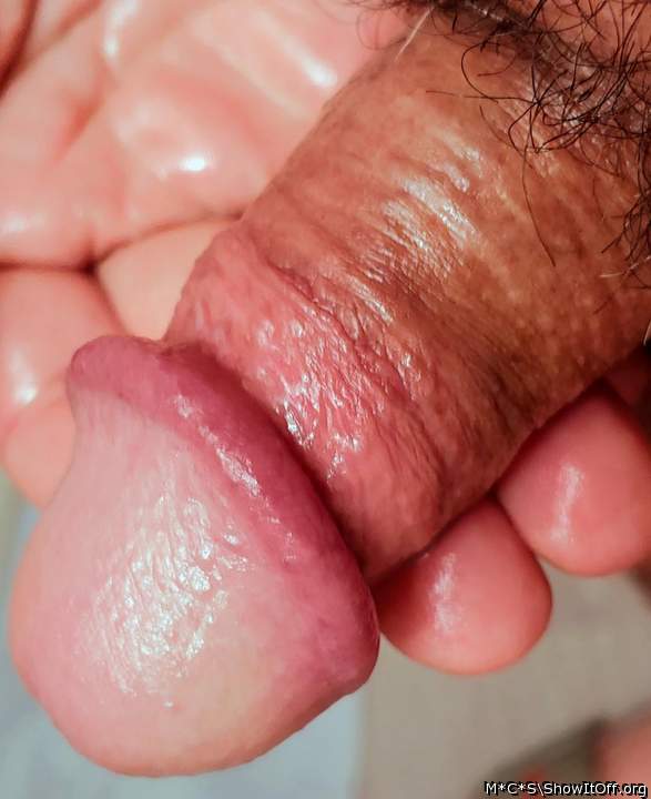 Photo of a private part from M*C*S