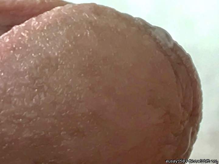 Photo of a short leg from eusay1587