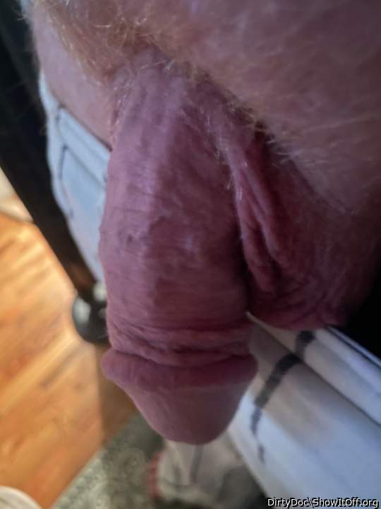 Photo of a love muscle from DirtyDoc