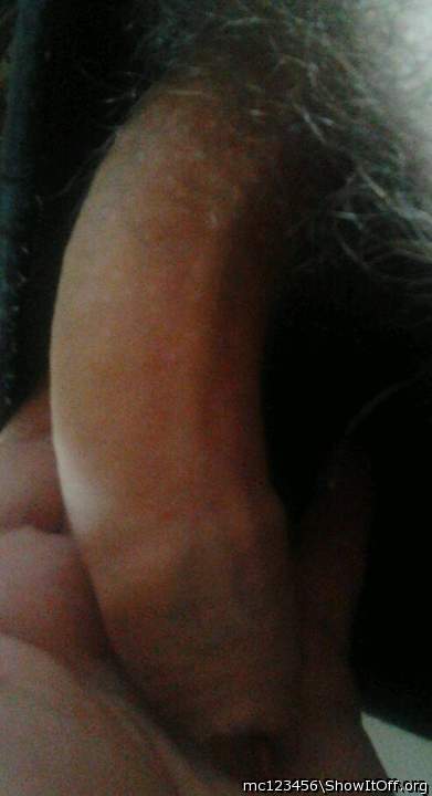 Photo of a penis from mc123456
