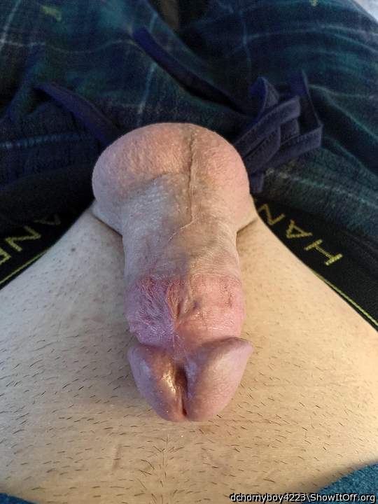 Photo of a bald-headed mouse from dchornyboy4223
