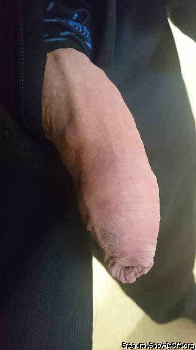 My foreskin