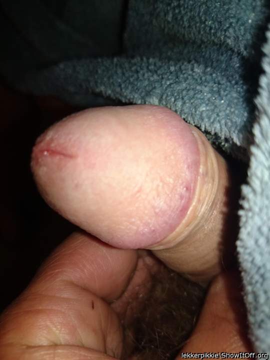 Photo of a short leg from lekkerpikkie