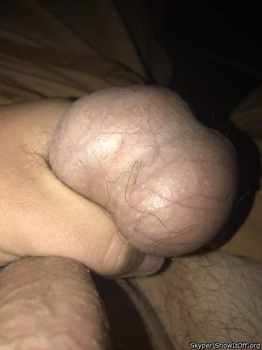 Photo of a shaft from Skyper