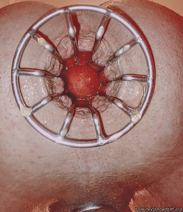 You can see right in my gapping hole