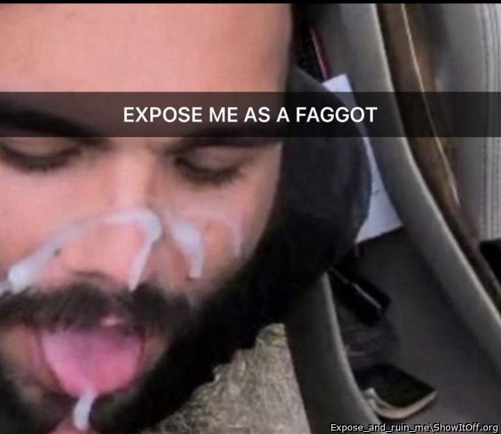 Help expose me