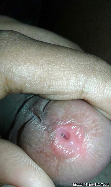 open up that pee hole! 