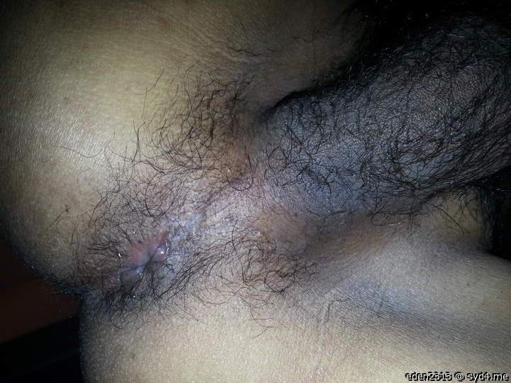 Perfect love hole and hairy balls