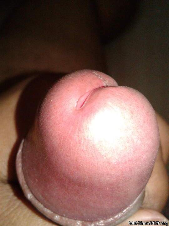 Photo of a short leg from tutu