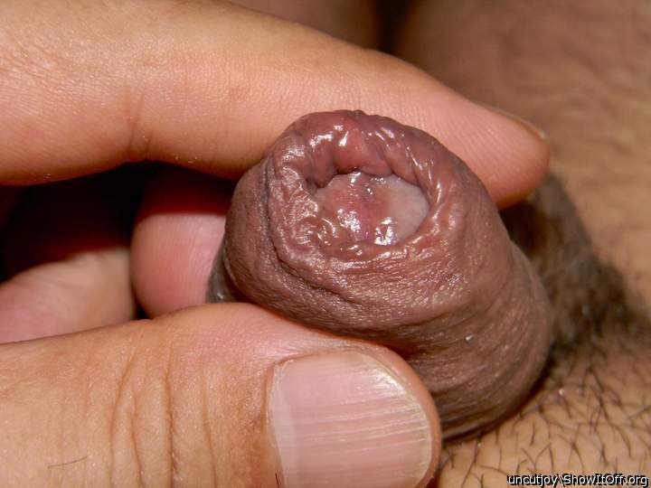 I can see the glans starting to show