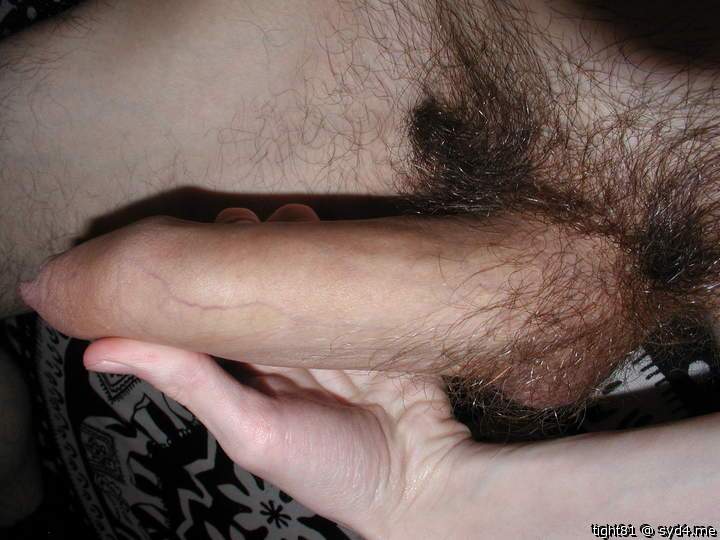 Phimosis