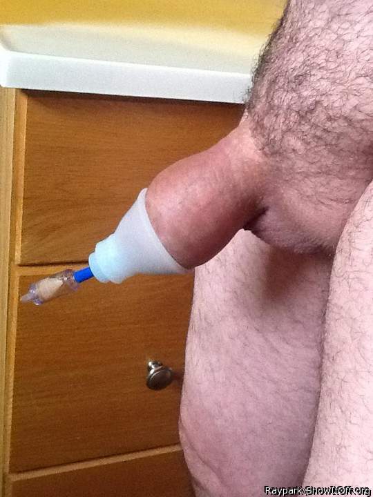 Foreskin restoration