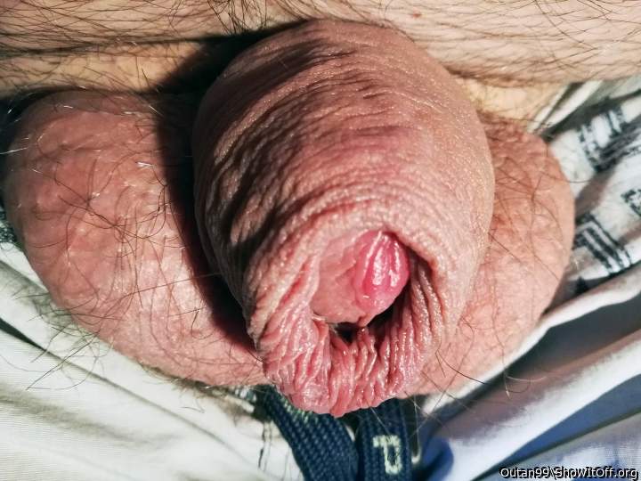 Foreskin 2