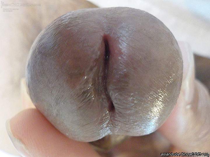 Photo of a sausage eye from asiandude