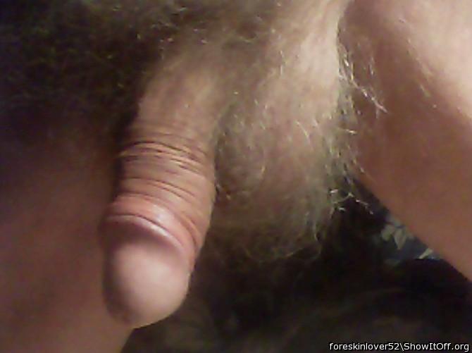 Photo of a wiener from foreskinlover52