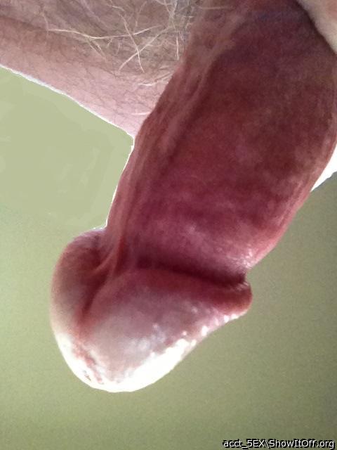 Photo of a prick from acct_5EX