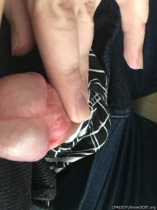 My Circumcised Dick-Do you like it?