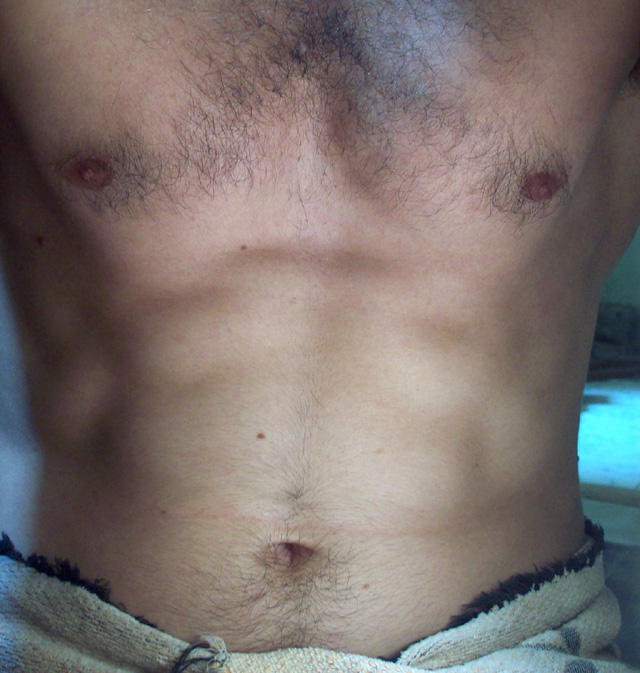 sixpack abs