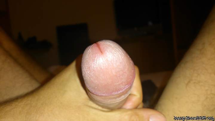 Photo of a short leg from joerg