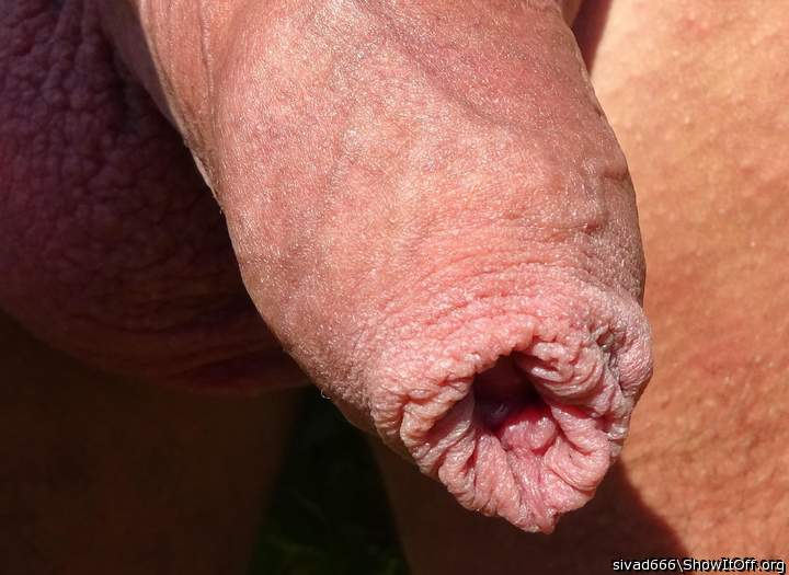 You have a super foreskin 