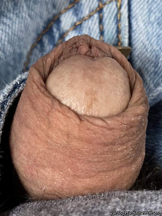 Photo of a middle leg from yardog319