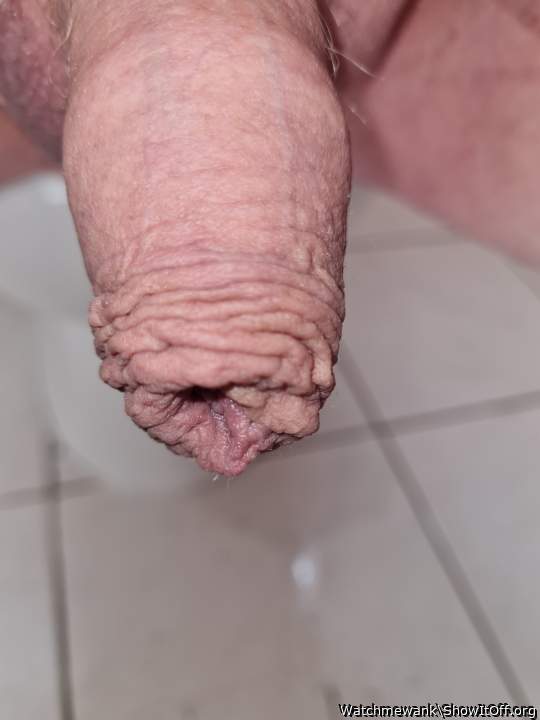 Foreskin  4