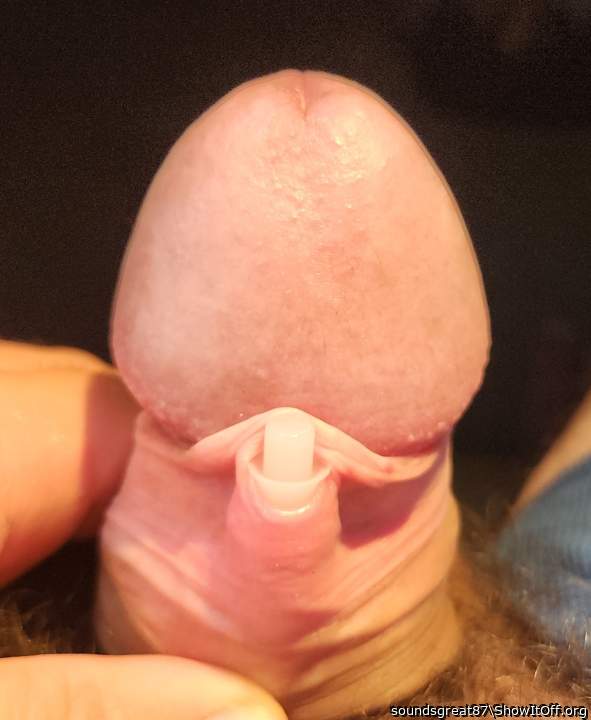 Foreskin Buttonhole in progress (2ga, 6mm)