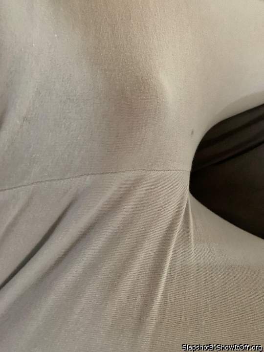 Photo of a penile from SlapshotB