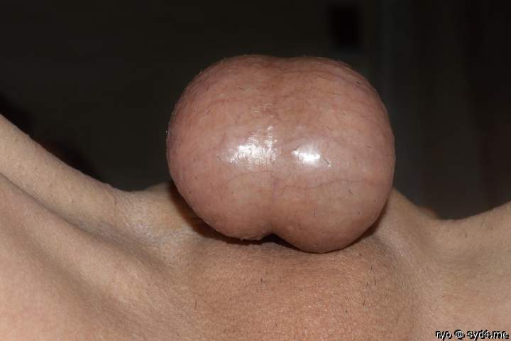 Testicles Photo from ryo