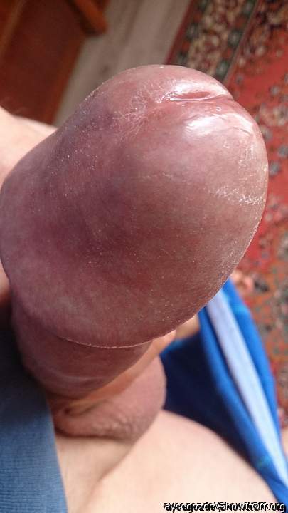 Photo of a middle leg from aysegozde