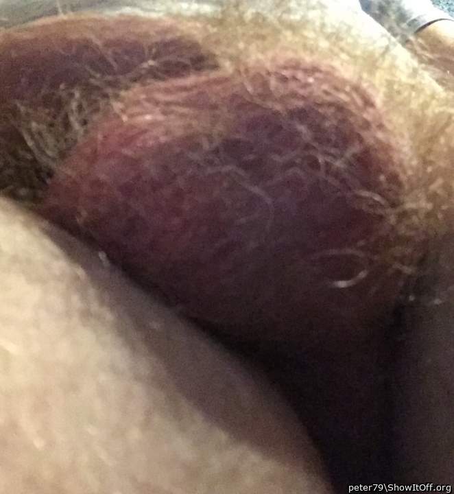 Lovely hairy orbs ~