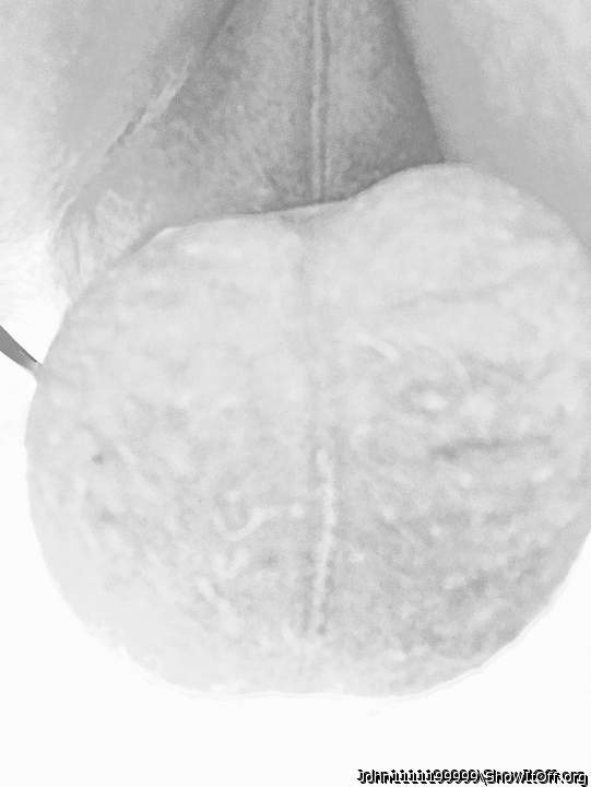 Testicles Photo from John1111199999