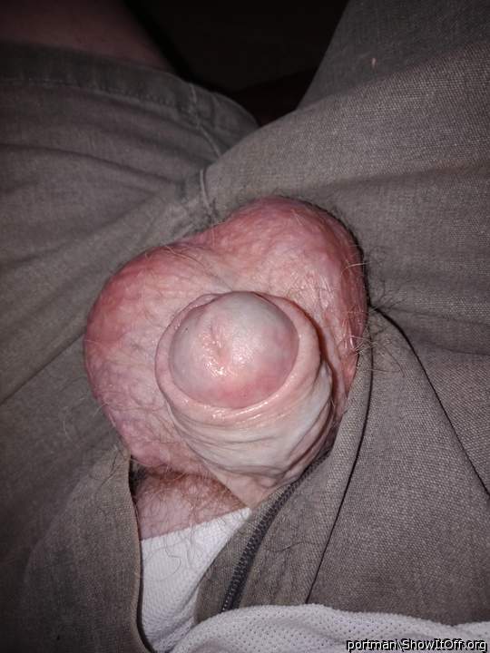 Dick