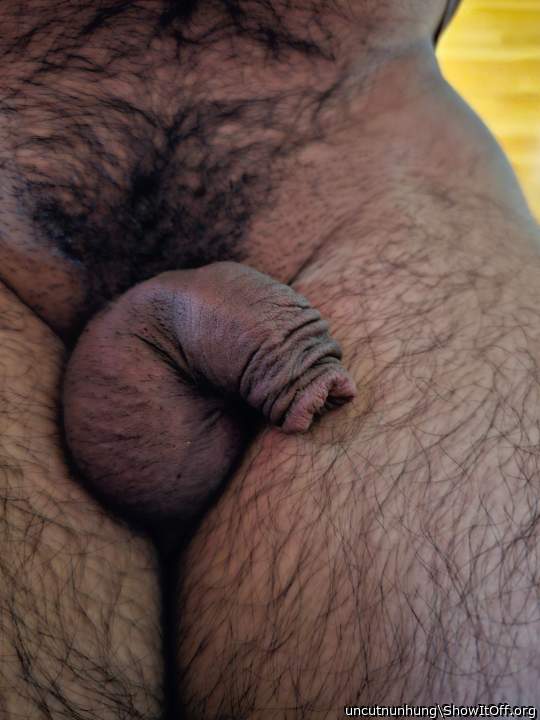 Photo of a penis from uncutnunhung