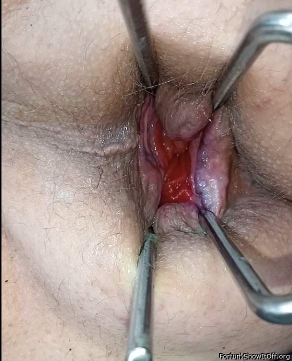 asshole stretching