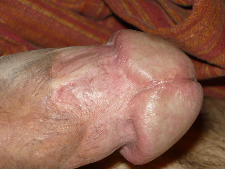 my dick