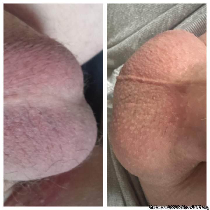Those need licked