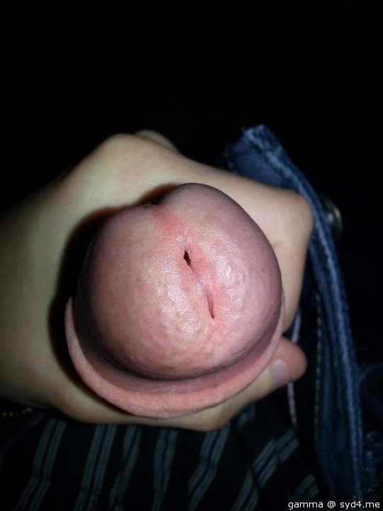 3rd pic