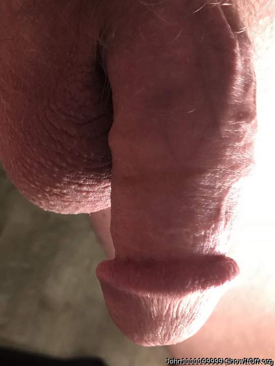 Photo of a short leg from John1111199999