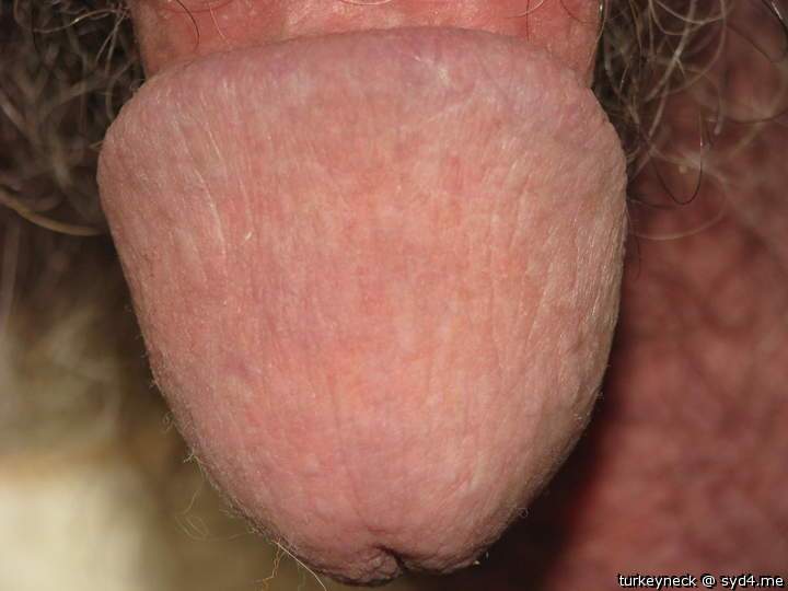 Photo of a middle leg from turkeyneck