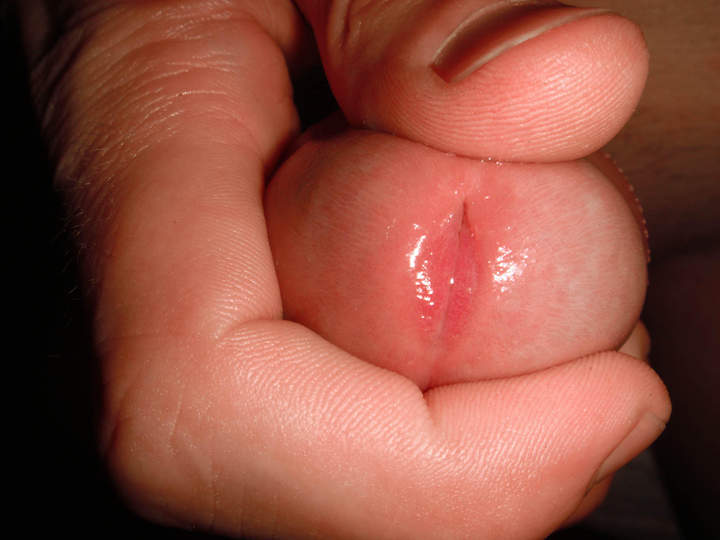 Photo of a middle leg from bilingual