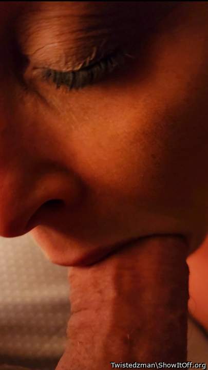 Photo of a penile from Twistedzman