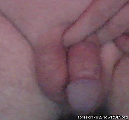 Photo of a third leg from foreskin78