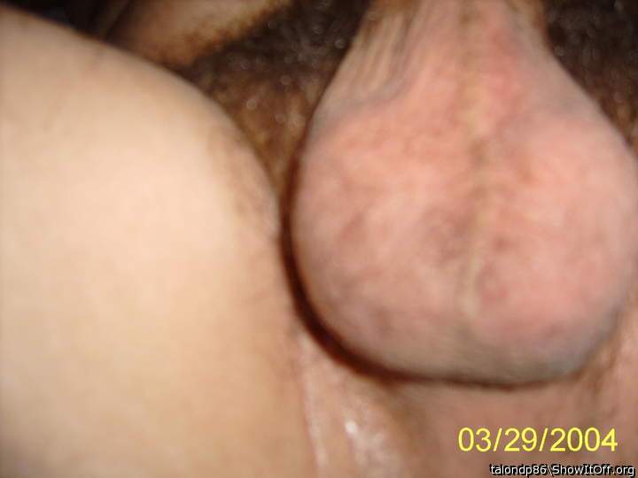 Testicles Photo from talondp86