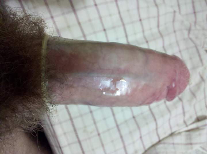 Photo of a shaft from skinb