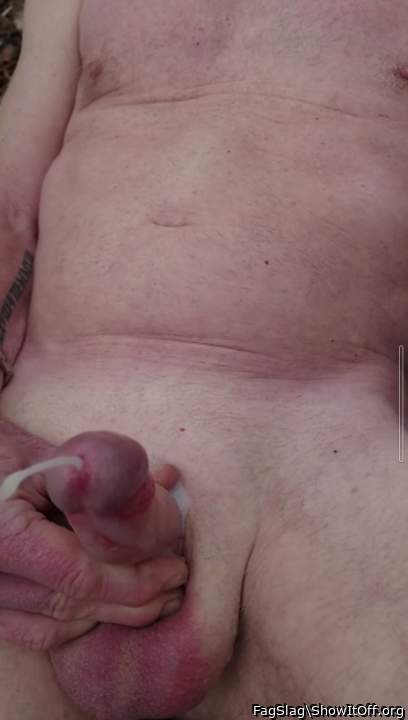 Photo of a penile from FagSlag