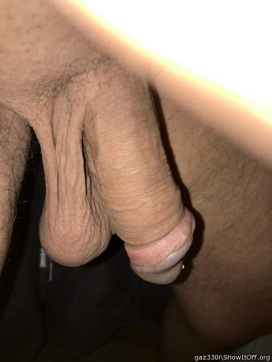 Photo of a penile from gaz330i