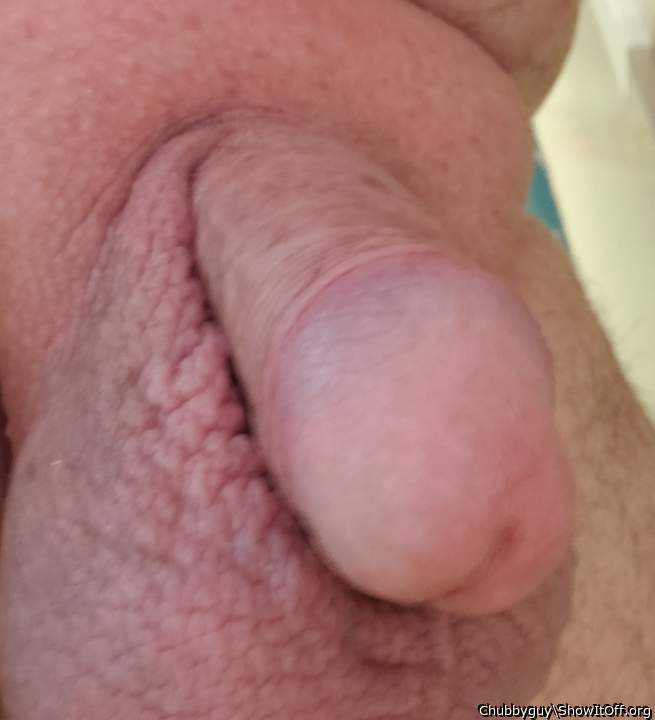 Photo of a prick from Chubbyguy