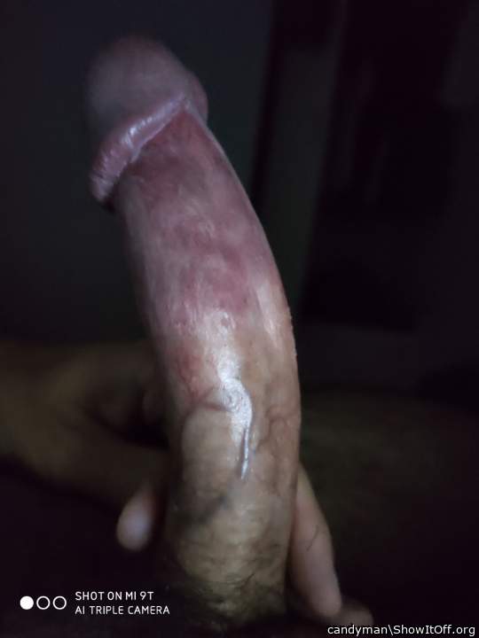 Photo of a penis from candyman